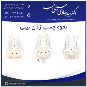 نحوه چسب زدن بینی