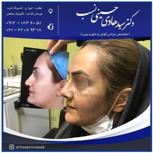 مراقبت های قبل از جراحی بینی